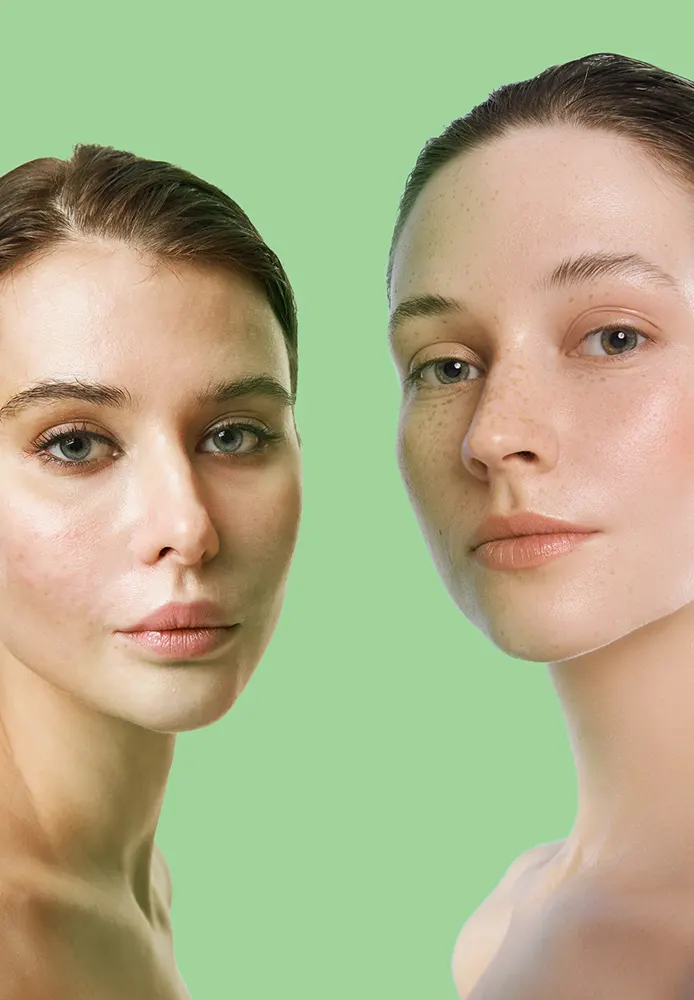 جل كريم للوجه اكتي كلير جلوبال ايه سي من ديرماكتيف ، 50 مل