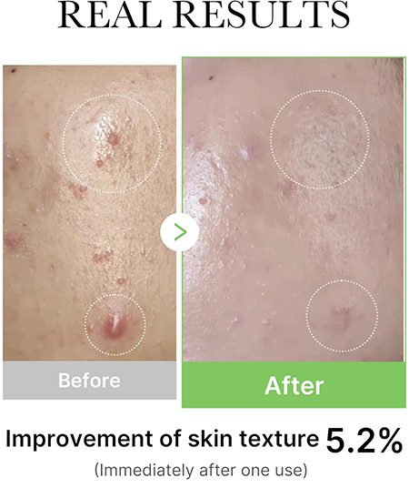 Medicube Exosome Cica Ampoule Serum, 30 Ml