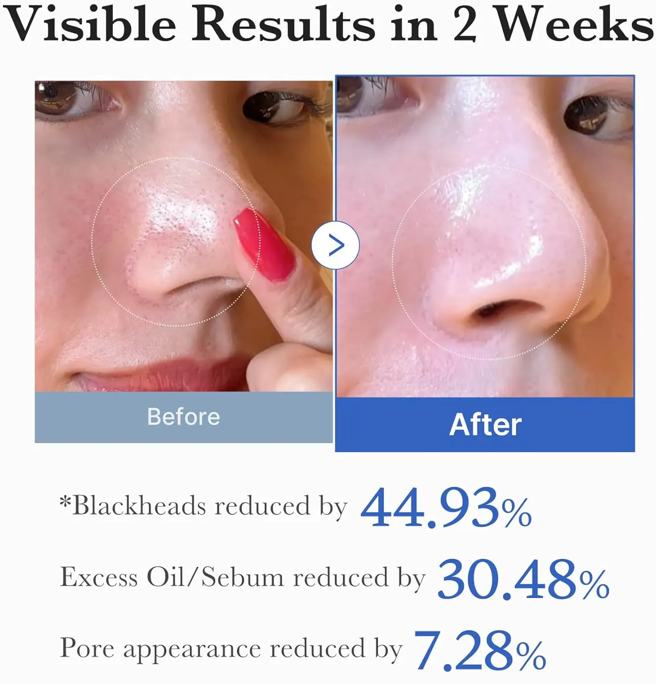 باد زيرو بور من ميديكيوب، 155 جم