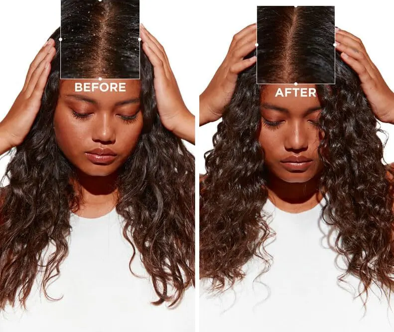 Sector Anti-dandruff Hair Shampoo, 120 Ml