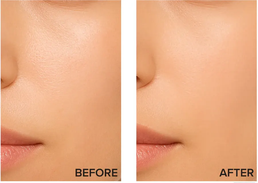 برايمر اول مات بيس من فوريفر52، Amb001