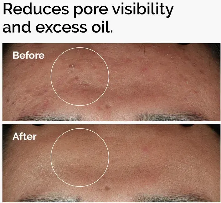 سيروم نياسيناميد 10% + زنك 1% من ذا اورديناري، 60 مل