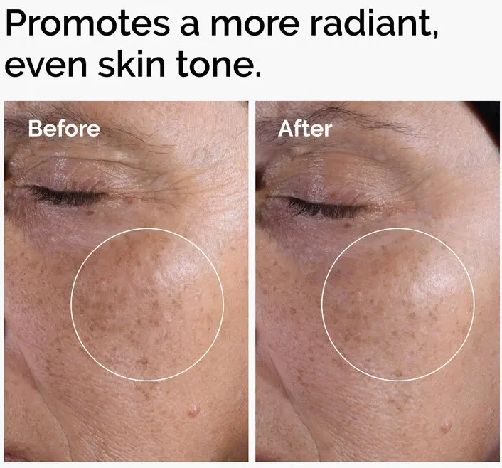 The Ordinary Glycolic Acid Exfoliating Toner ,240 Ml