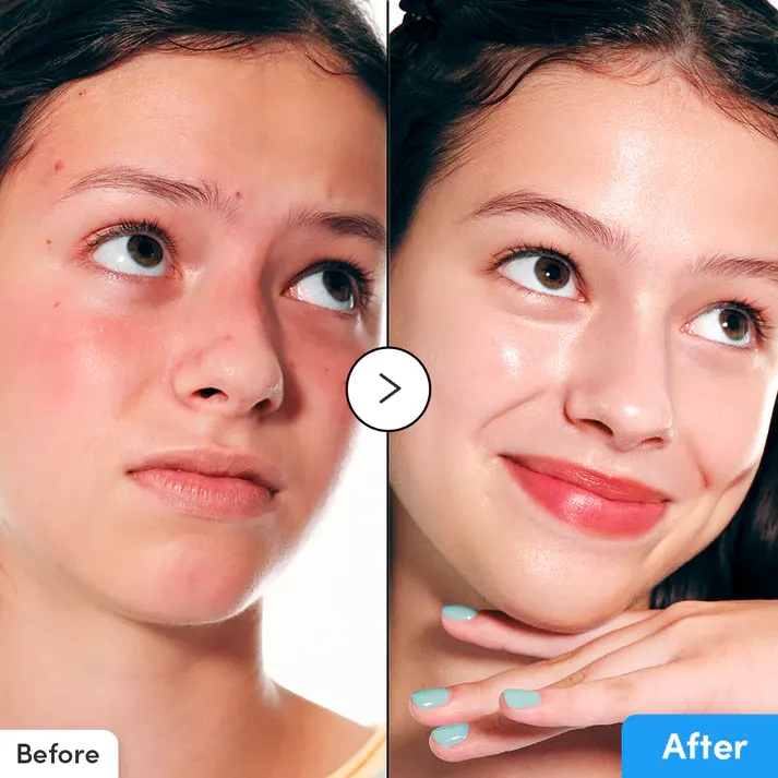 Eqqual Berry Hyaltoin Flooding Serum, 30 Ml