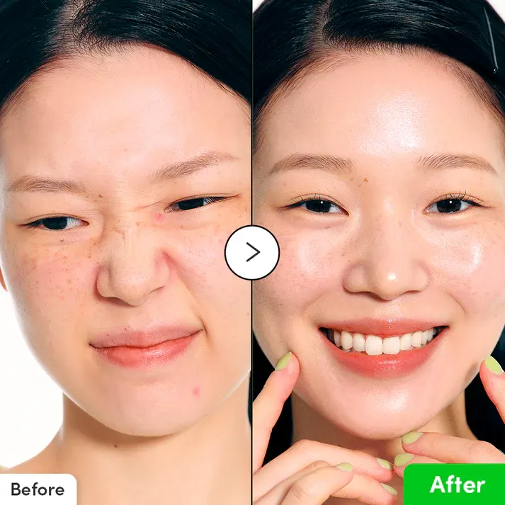 Eqqual Berry Aloe Pdrn Calming Serum, 30 Ml